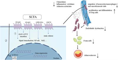 Short-chain fatty acids are potential goalkeepers of atherosclerosis